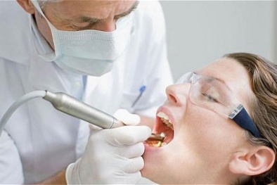 Rụng răng... vì thuốc tẩy trắng
